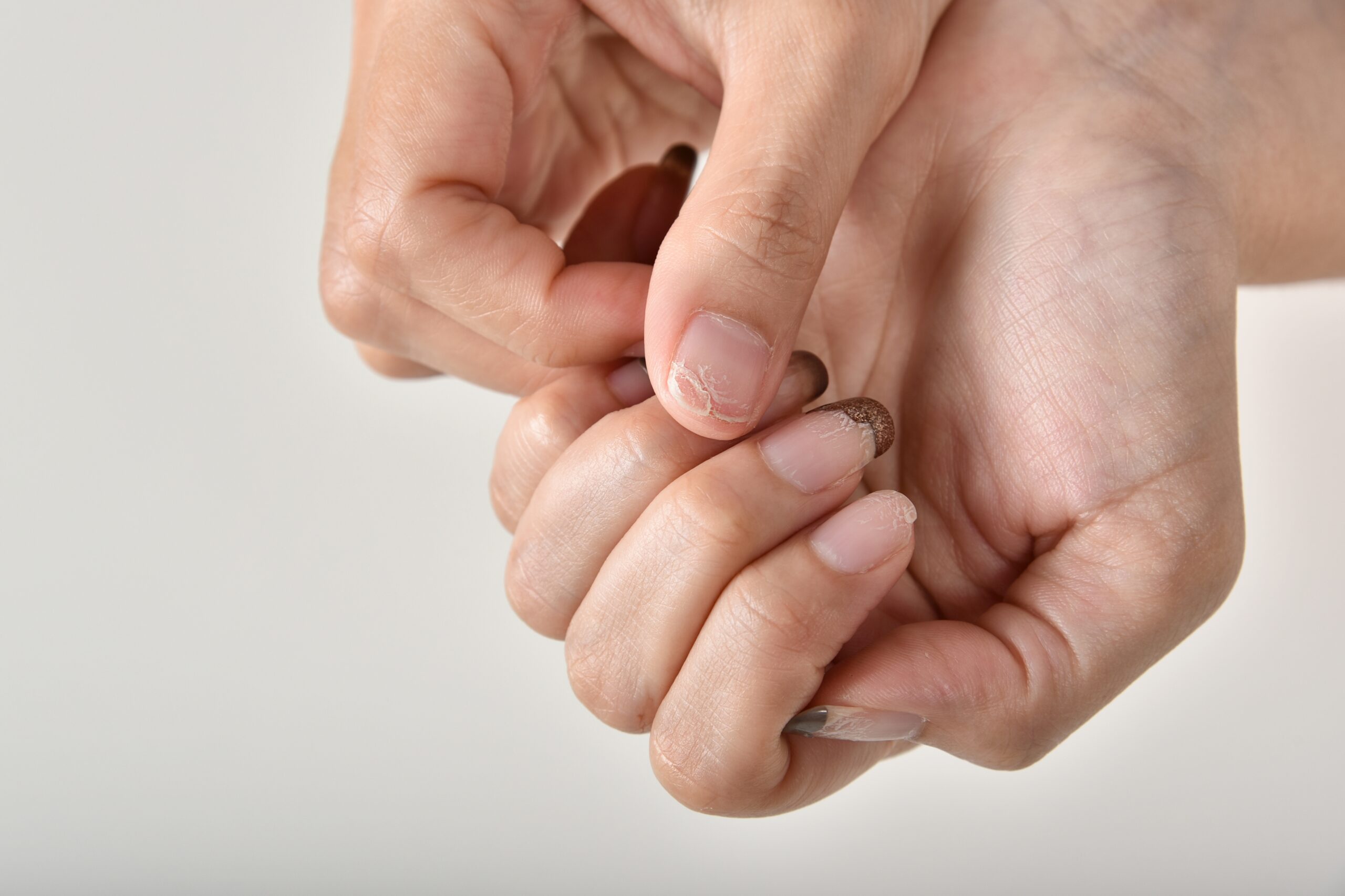 Strengthen your weak brittle nails